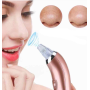 Вакуумний апарат для чищення пор Beauty Skin Care XN-8030 · Прилад для очищення пор · Апаратна чистка обличчя